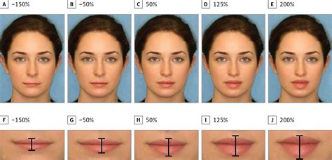 A Quantitative Approach To Determining The Ideal Female Lip Aesthetic