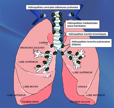 Adénopathies Lymphatiques Du Poumon Palli Science Site Officiel De