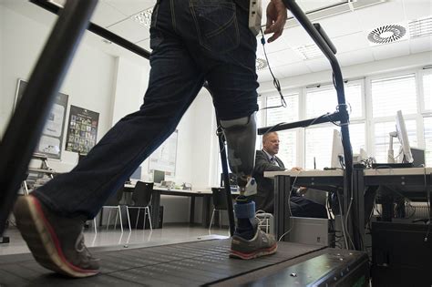 Worlds First ‘feeling Leg Prosthesis Offers New Hope To Amputees