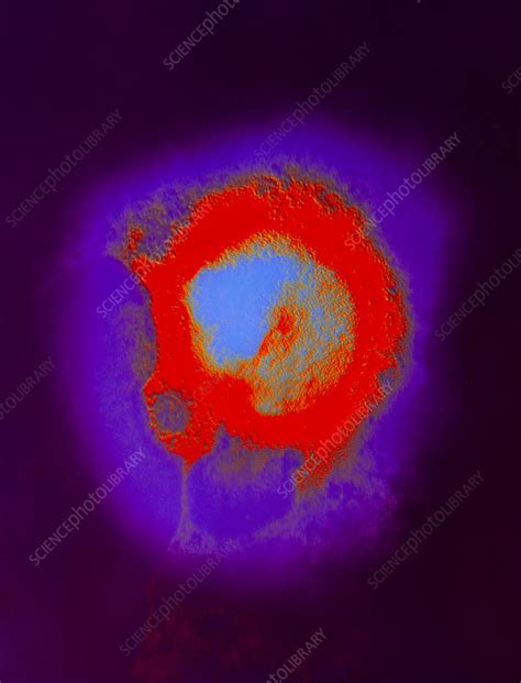 Coloured Tem Negative Stain Of A Mumps Virus Stock Image M050