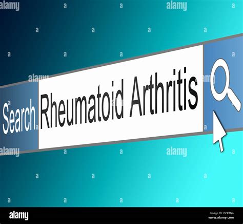 Treating Arthritis Hi Res Stock Photography And Images Alamy