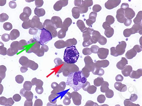 Granulated White Cells Peripheral Blood 1