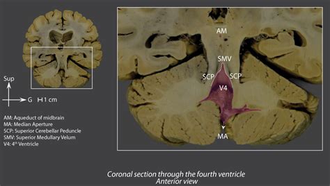 Fourth Ventricle Brain Inter Atlas