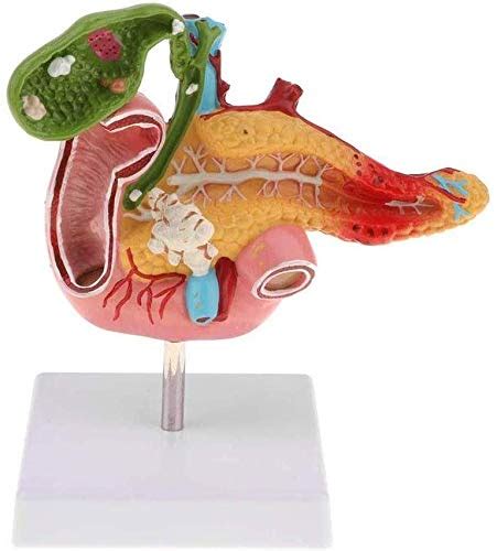 Buy LBYLYH Life Size Human Pancreas Model Duodenal Gallbladder Disease Stomach And Duodenum