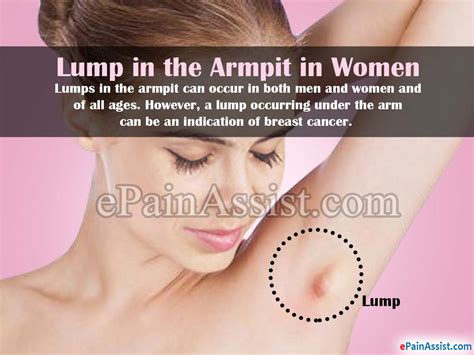 Is Lump Under Armpit Breast Cancer