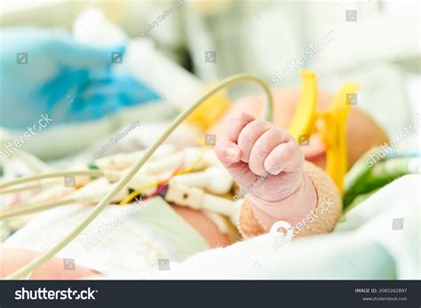 962 Infant Icu Images Stock Photos And Vectors Shutterstock