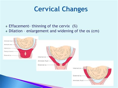 Ppt Chapter 17 Powerpoint Presentation Free Download Id1076776