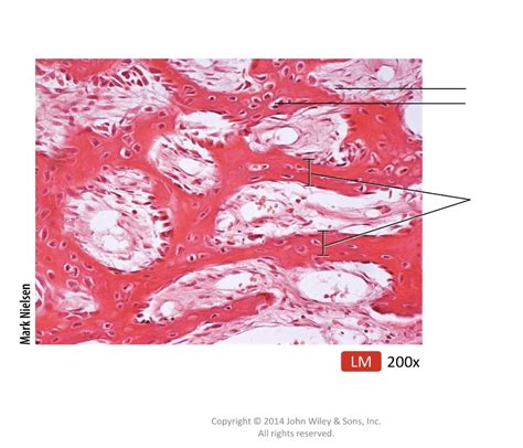 Label The Microscopic Anatomy Of Spongy Bone