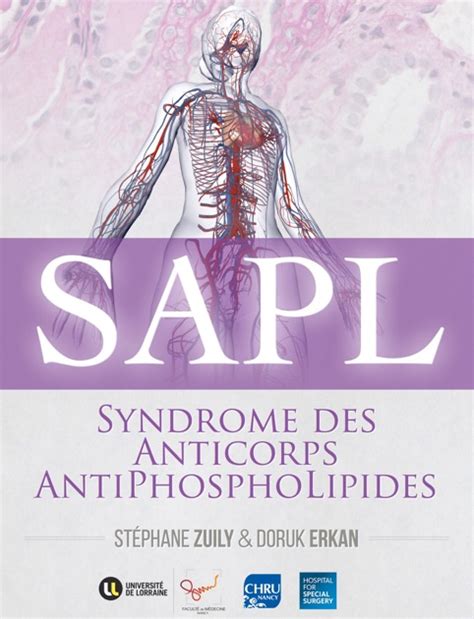 Syndrome des Anticorps AntiPhosphoLipides écrit par Laurent Phialy