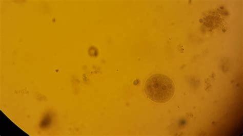 temenin coli