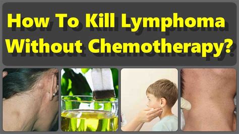How To Kill Lymphoma Without Chemotherapy But With The Natural Remedies