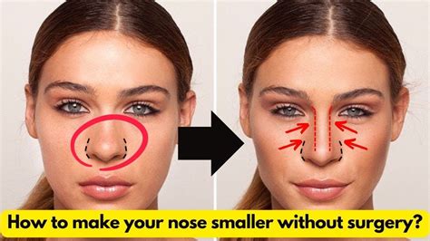 How To Make Your Nose Smaller Without Surgery Youtube