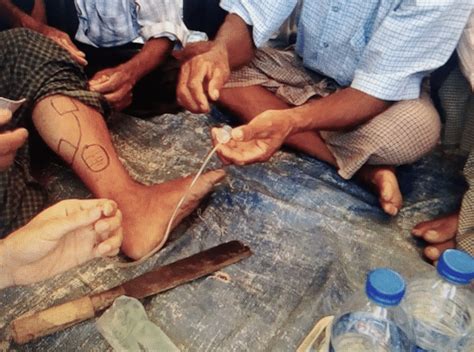 Community Members Illustrating Traditional Healing Methods Some Of The Download Scientific