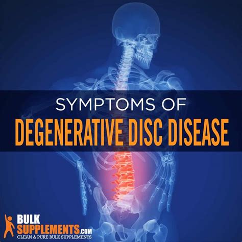 Degenerative Disc Disease Symptoms Causes Treatment