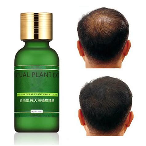 hair growth serum hair care hair growth essential oil authentic herbs hair loss liquid health