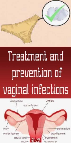 Treatment And Prevention Of Vaginal Infections