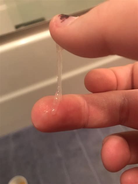 One way to know if you're ovulating is to track your basal body temperature over a series of months. Clear and strechy discharge... sign of ovulation?? TMI pic ...