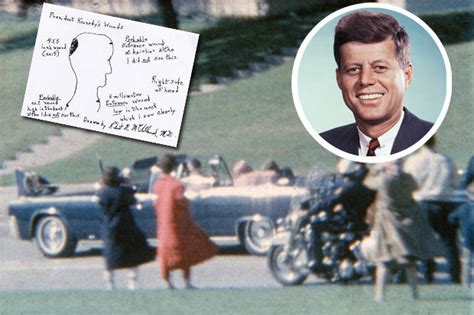 Jfk Assassination Conspiracy Theory Proof As Sketch Shows Second