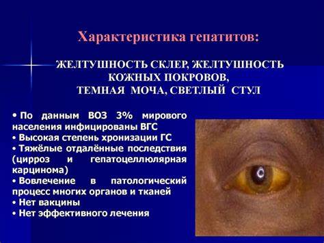 Вирусные гепатиты: А, В, С, Д, Е. Общая характеристика, этиология Картинка - Вирусные гепатиты: А, В, С, Д, Е. Общая характеристика, этиология