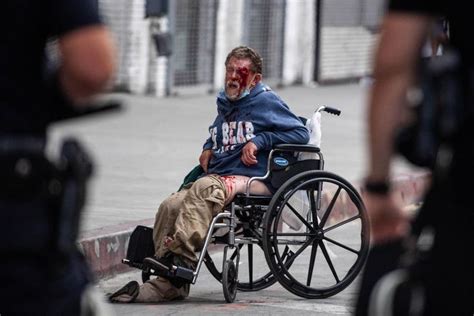 Lapd Shoots Homeless Man In The Face With Less Than Lethal Bullet In 2020 Homeless Man Pics