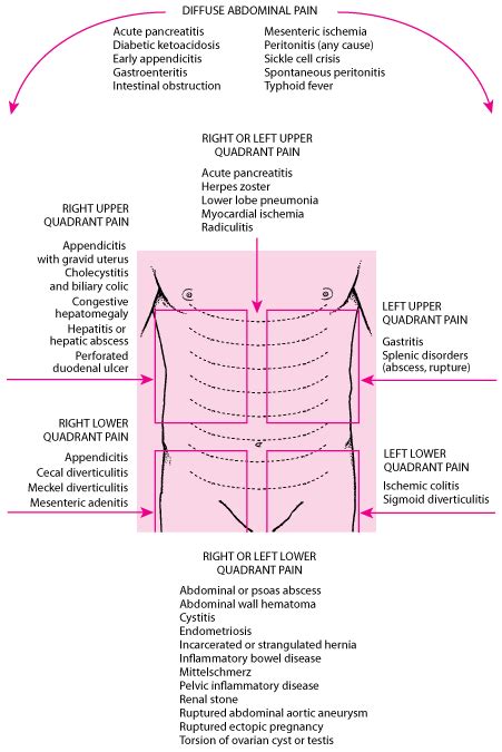 Figure Location Of Abdominal Pain And Possible Causes Merck Manuals