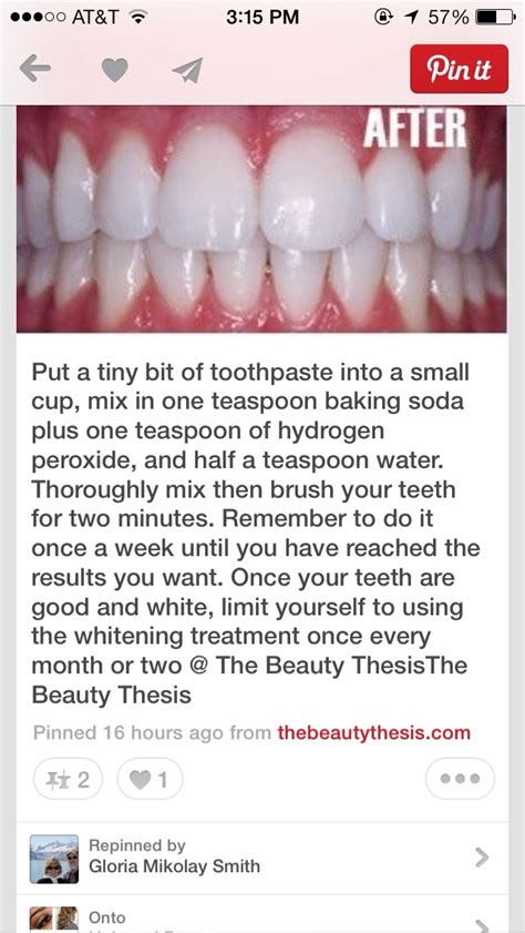 How To Get White Teeth Fast Easy Strong Trusper