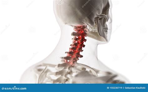 An Arthritic Cervical Spine Stock Illustration Illustration Of Health