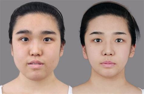Crazy Before And After Photos Of South Korean Plastic Surgery Page 6