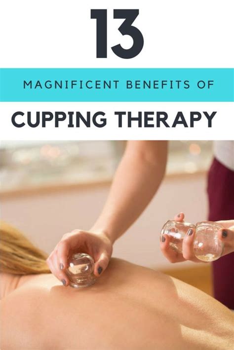 cupping therapy benefits 13 things you should know about it with images cupping therapy