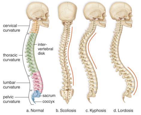 Discover the types of treatments we offer our patients. Curvature of the Spine - Abnormal, Symptoms, Pictures