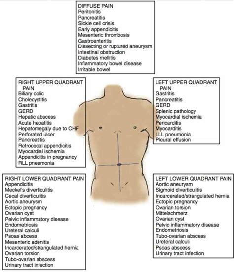 Using several layered illustrations from the abdominal obliques to the intercostal external muscles, the anatomical chart shows how each muscle works with the surrounding systems. Picture Of Abdominal Quadrants | MedicineBTG.com
