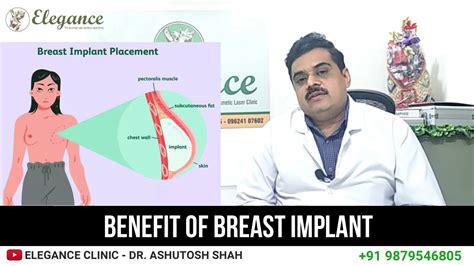 Benefit Of Breast Implant Surgery Youtube