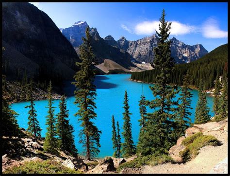 Canadian Rockies Beautiful Site Another Place To Visit Again Lake