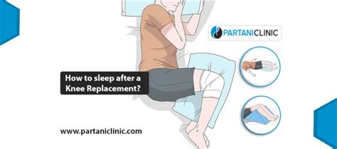 How To Sleep After Knee Replacement Surgery Dr Arun Partani