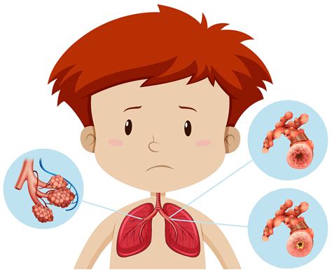 A Boy With Bronchitis 292584 Vector Art At Vecteezy