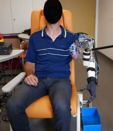 A prosthetic arm that decodes phantom limb movements | CNRS