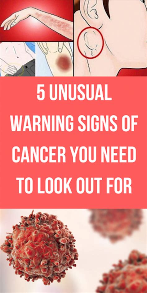 The 5 early warning signs of prostate cancer and how to prevent it early warning sign #1. 5 Unusual Warning Signs Of Cancer You Have To Look Out For ...