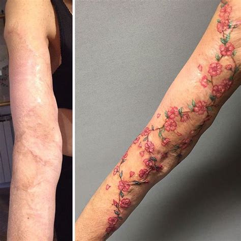 Scars are tattoos with better stories. Tattoos over Scars - Here's what you need to Know