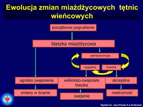 Mia D Yca T Tnic Przyczyny Objawy Metody Lecznicze Hellozdrowie Hot