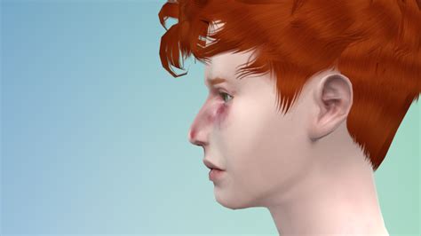 Mechohans — Skin Detail Bruising Sims 4 Bruising Nose Lips