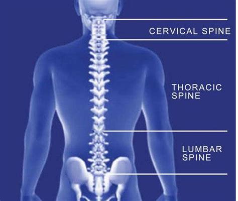 What Is Spondylosis Stephen P Courtney Md Orthopedic Spine Surgeon
