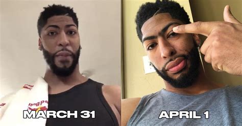 No Anthony Davis Did Not Shave His Unibrow