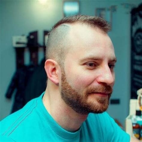 Viral Over Hairstyles For Balding Men Most Searching