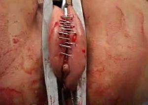 Needle Pain BDSM Extreme Tit Torture Pussy Torture TG Page 5