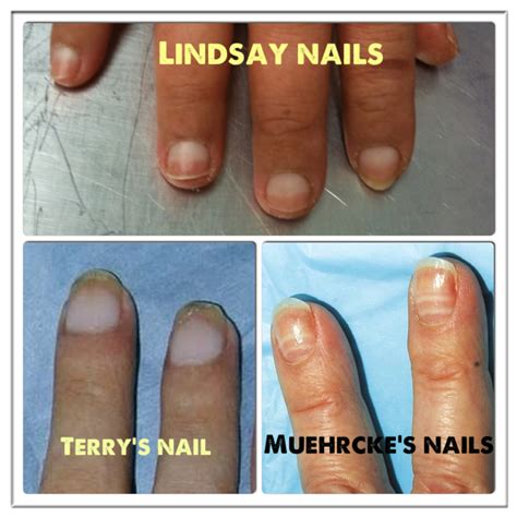 Top 128 Terrys Nails Vs Lindsays Nails Architectures Eric