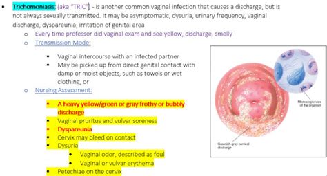 Sexually Transmitted Infections Nursing Study Guide Etsy