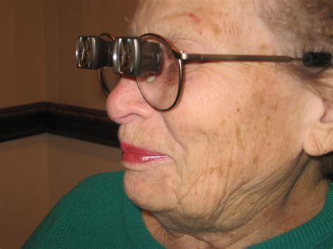 low vision eyeglasses macular degeneration patients of the month