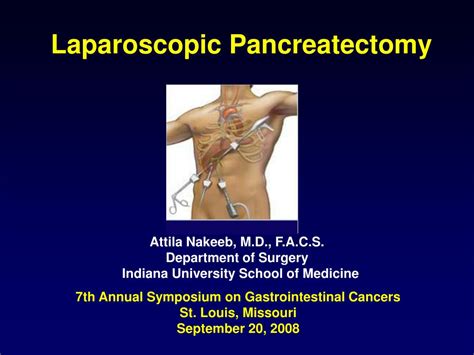 PPT Laparoscopic Pancreatectomy PowerPoint Presentation Free Download ID