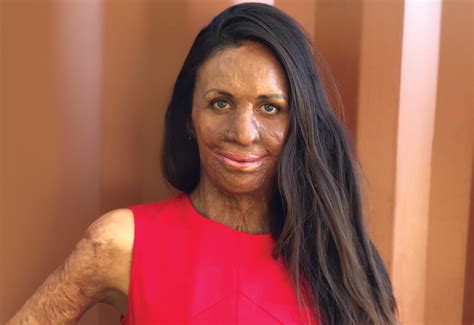 Turia Pitt On The Engineering Mindset That Helped Her Get Through Tough Times Create
