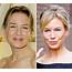Renée Zellweger Turns 51 How Plastic Surgery Changed Her Look Over The 